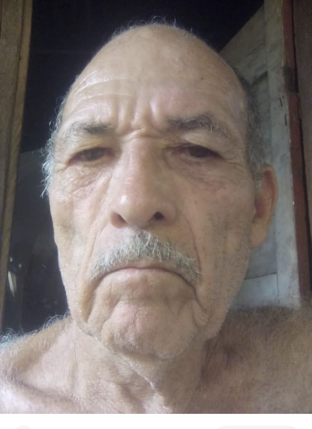 Simón Serrano cojo